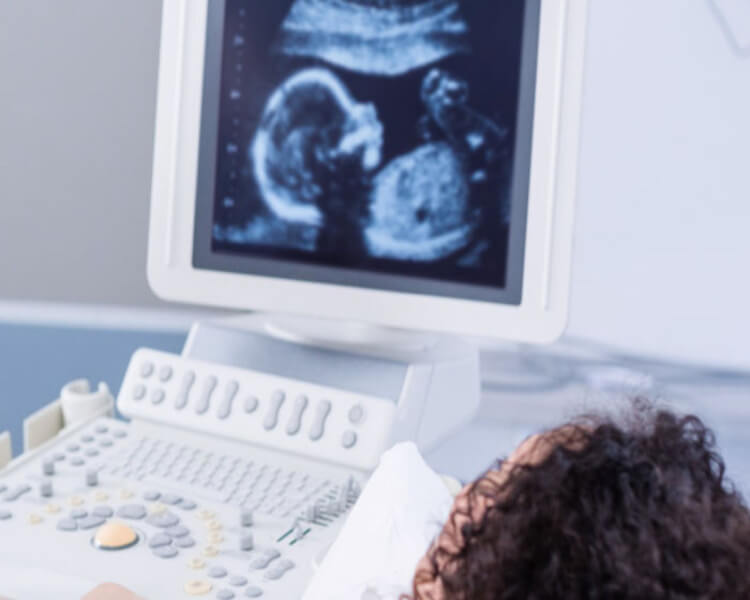 3D/4D Sonography