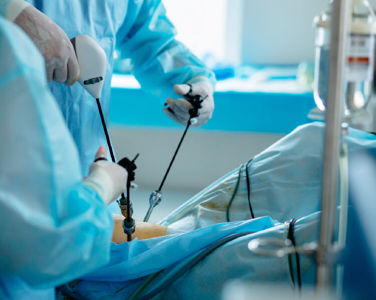 Laparoscopy Surgery