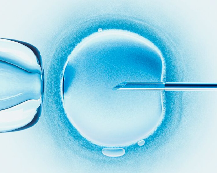 In Vitro Fertilization